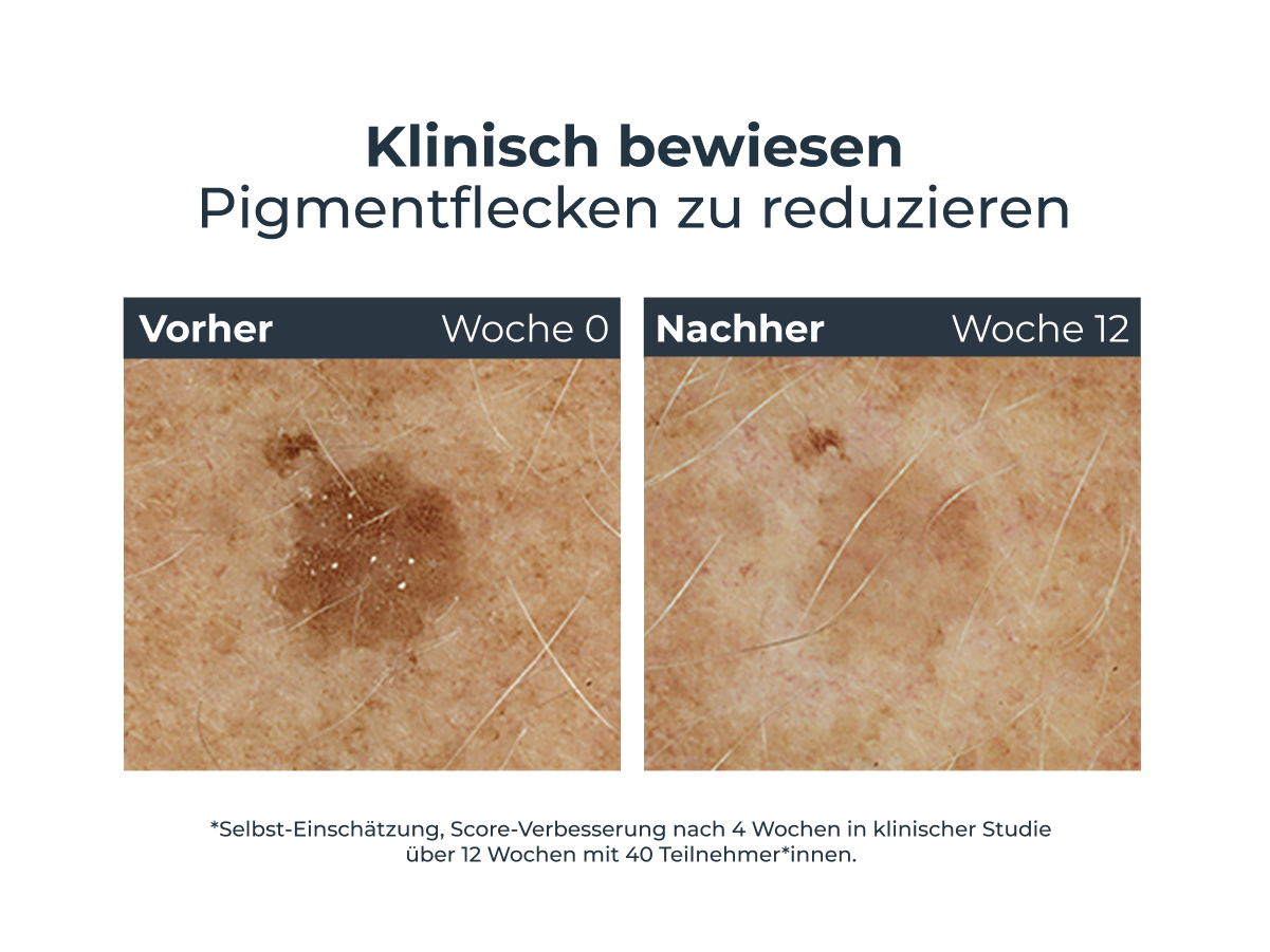 Nachtpflege Nachtcreme Gesichtscreme Antifaltencreme Feuchtigkeitscreme Haut Faltencreme Anti Aging Creme Gesichtspflege Anti Ageing Hyaluronsäure Anti Age Hyaluron Filler Hautalterung vorbeugen Antifalten gegen Falten straffe Haut